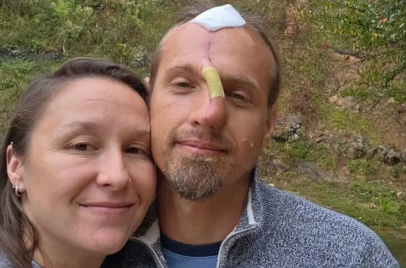 Life changed in a split second the moment Dustin Low tried to break up a fight between two...